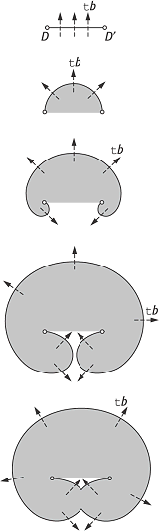 Versetzungsquelle