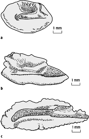 Otolithen